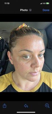 After microneedling facial I am glowing!