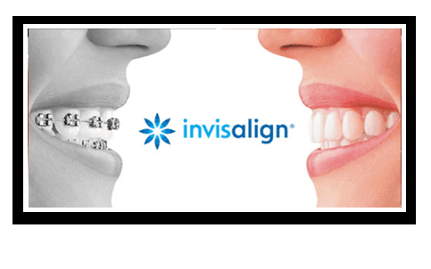 Offering Invisalign and Whitening Services!!