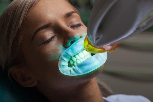 Teeth Whitening