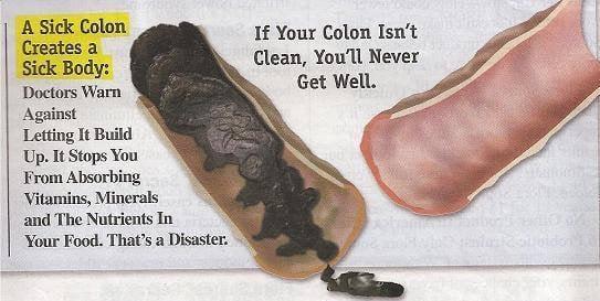 Feeling Sluggish, perhaps its your colon?