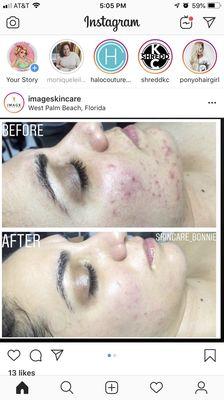 Image skincare