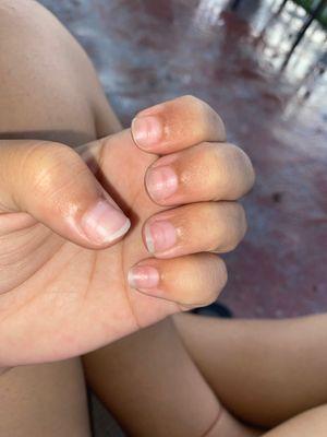 They do not care about your nail health !!