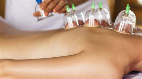 Massage Cupping