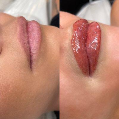 Lip Blush before and after