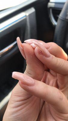 Cut through my nail horribly