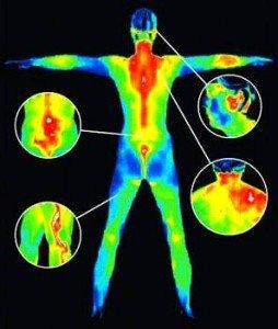 BRAS Thermography