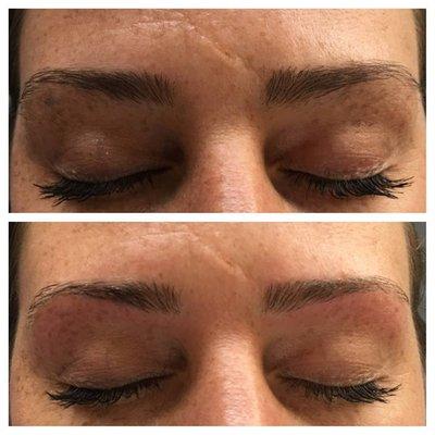 Eyebrow Threading, Before & After