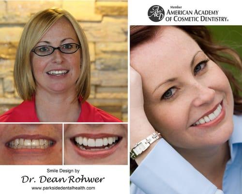 Smile Design Case by Dr. Rohwer