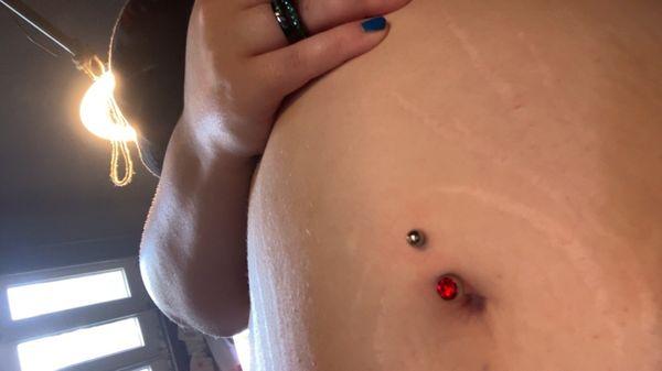 My new belly piercing they did.