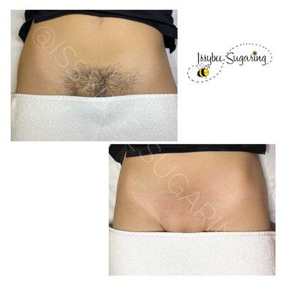 Great Brazilian sugaring done by yours truly. Sugaring the new smooth.