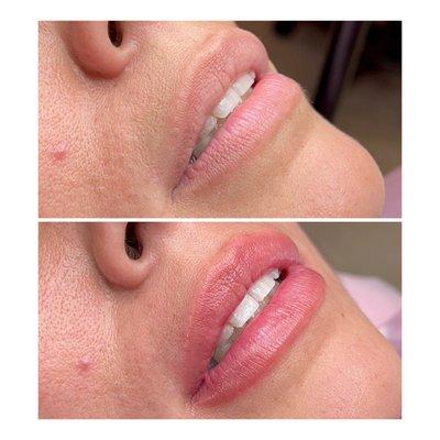 LipBlush.Before and after.