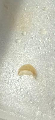 This is the actual piece of finger nail tip that was cooked in the food.