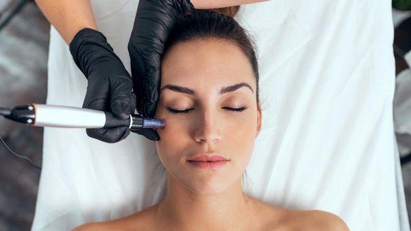 Genius RF/Microneedling