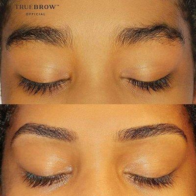 Before and After TrueBrow Transformation