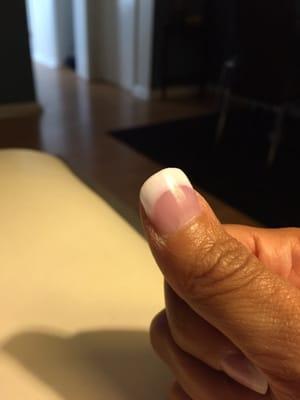 Bumpy nail