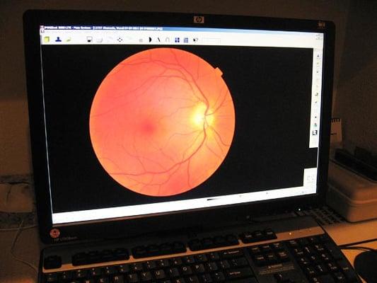 Retinal scans for early detection of eye problems.