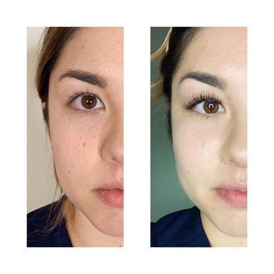 Before and Afters Classic Eye Lash Extensions.