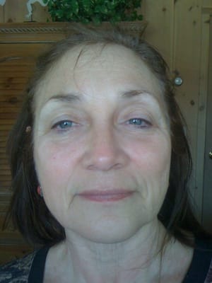 AboutFace facelift massage - After