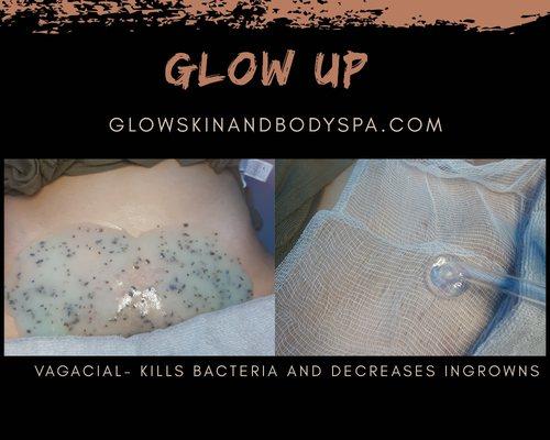 Vagacial to kill bacteria and treat ingrown hairs