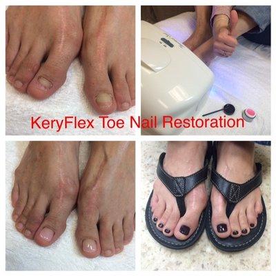 Jacqui can create a beautiful nail using KeryFlex, call for information or visit our website.