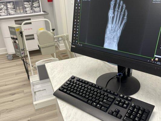 State of the Art digital X-ray available on site to immediately diagnose your Foot and Ankle related conditions