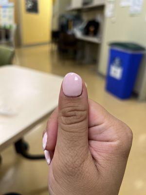 Odd shaped thumbnail...does not match rest of nails either