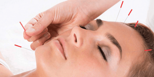 Cosmetic Acupuncture--to tone and uplift the sagging facial muscles. To decreasing the wrinkle and the fine lines.