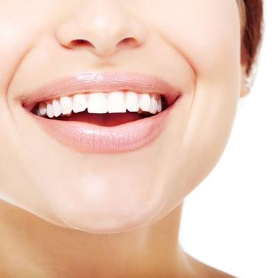 Teeth Whitening Encinitas, CA