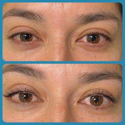 Lashlift with thickening treatment.