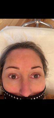 After Microblading