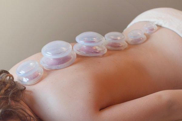 Massage Cupping is a client favorite!