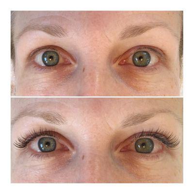 Before & After - Classic Lash Set