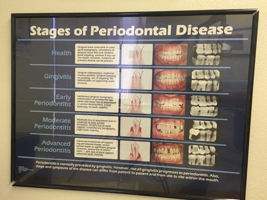 Periodontal Health