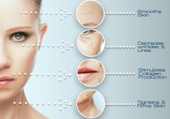 The benefits of CryoFacial at Elite