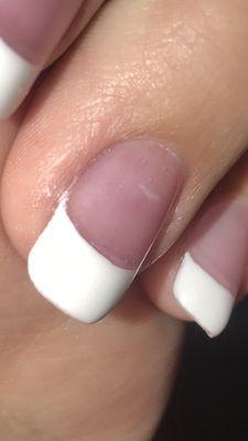 Extreme air bubbles within the nail