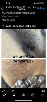 Before and after armpit wax