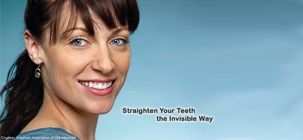 Invisalign