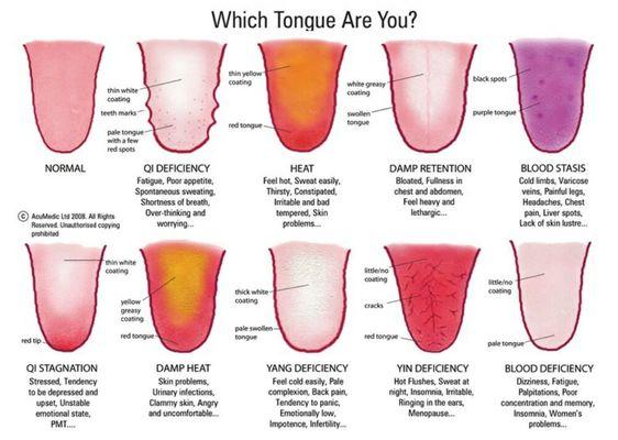 Tongue diagnosis