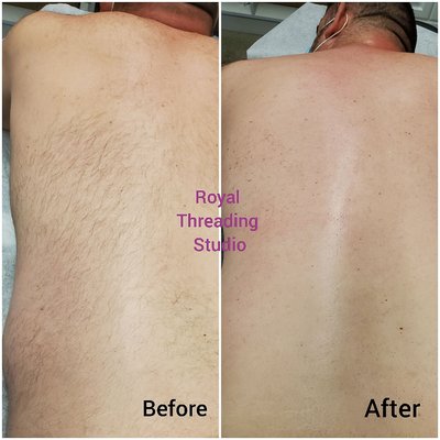 Men's back waxing.