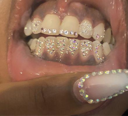 Tooth gems