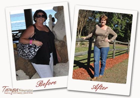 Tampa Rejuvenation Testimonial