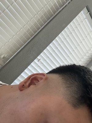 Bald fade