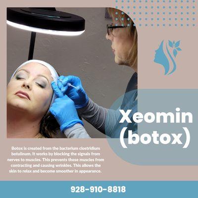 Xeomin/botox treatment