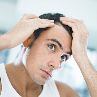 Receding hairline treatment.