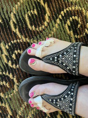 Watermelon toenails