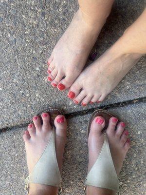 Free toe pic