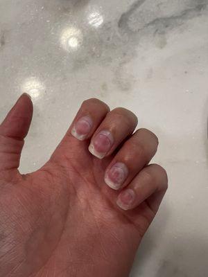 Acrylic Nail Removal