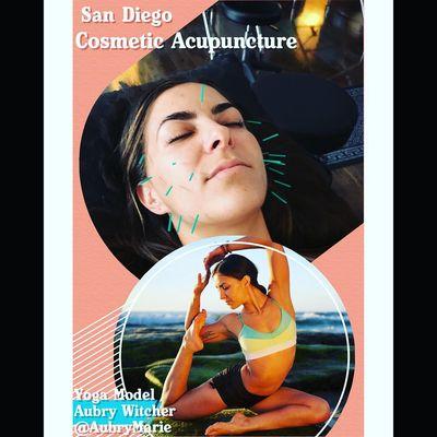 San Diego Cosmetic Acupuncture