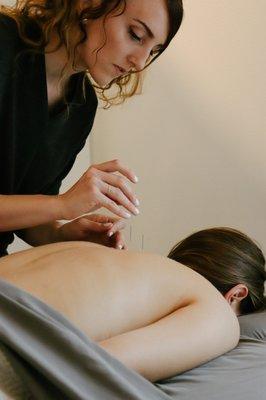 Besides our massage options, all of our treatments include a component of acupuncture.