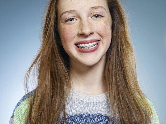 Smile, you are going to have a beautiful smile when you are done with braces.